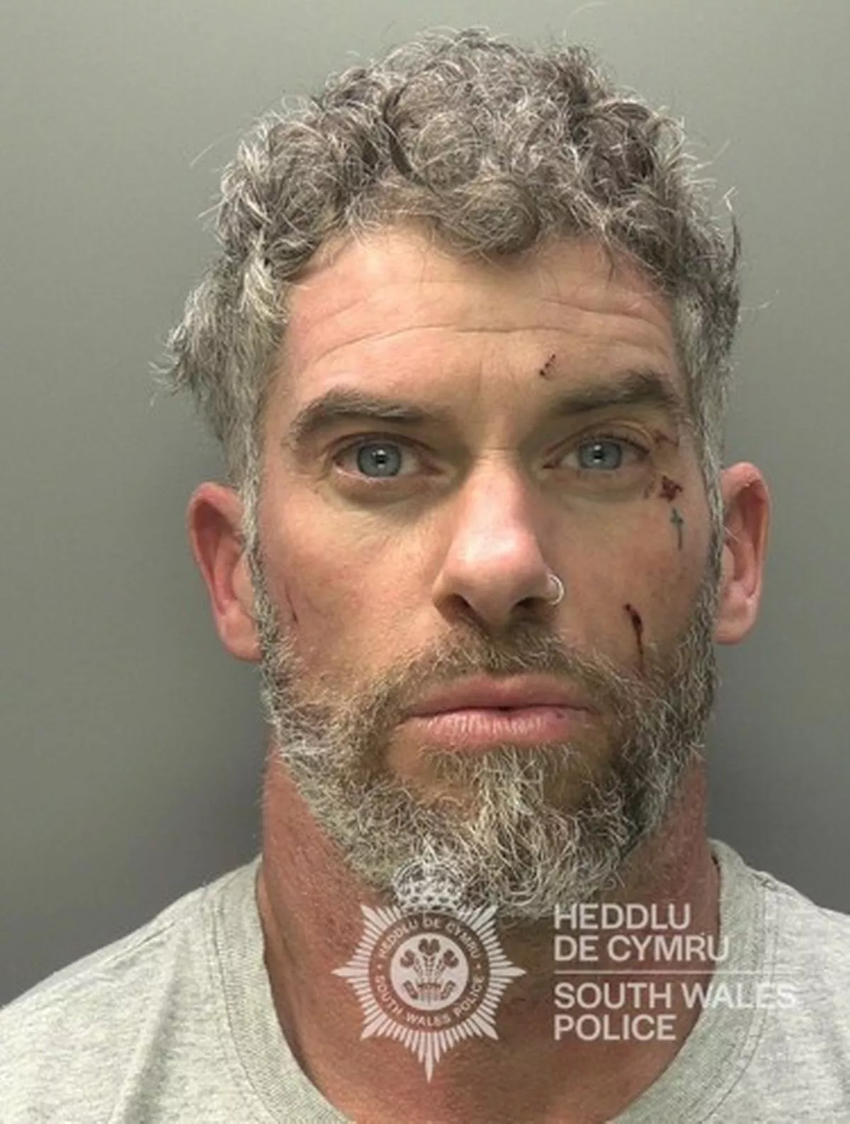 Featured image for “Man Jailed for Punching Pregnant Girlfriend in Stomach”