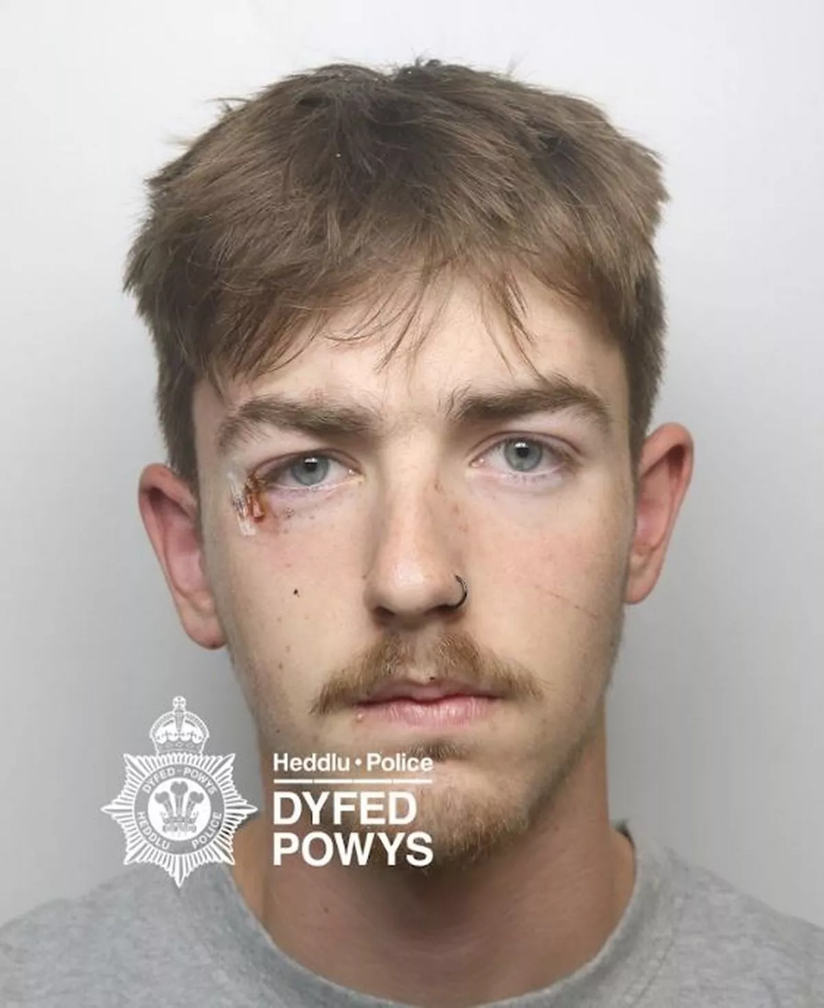 Featured image for “Teen jailed after crash left passenger’s head through windscreen”