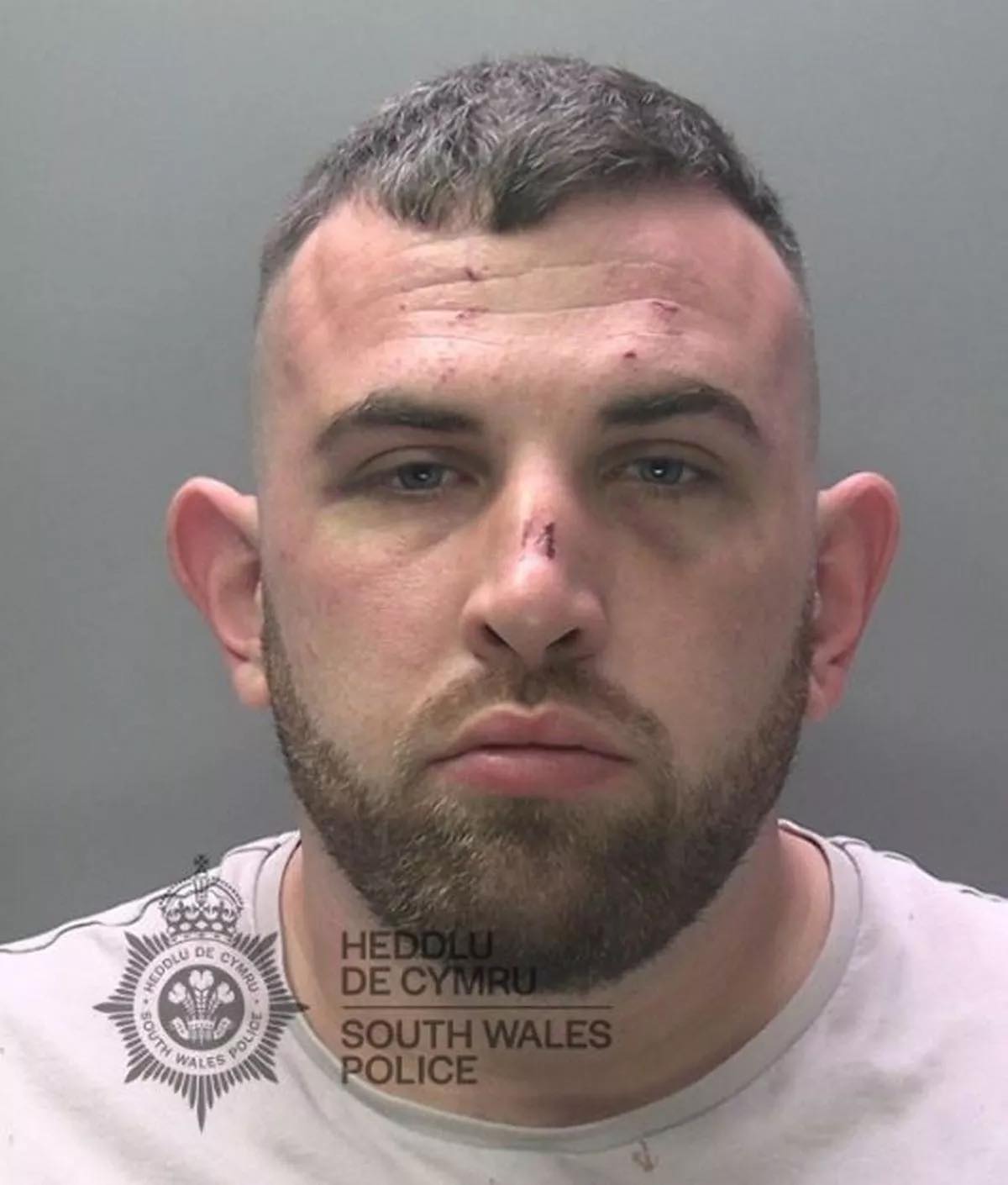 Featured image for “Man jailed for fracturing fiancée’s eye socket in attack”