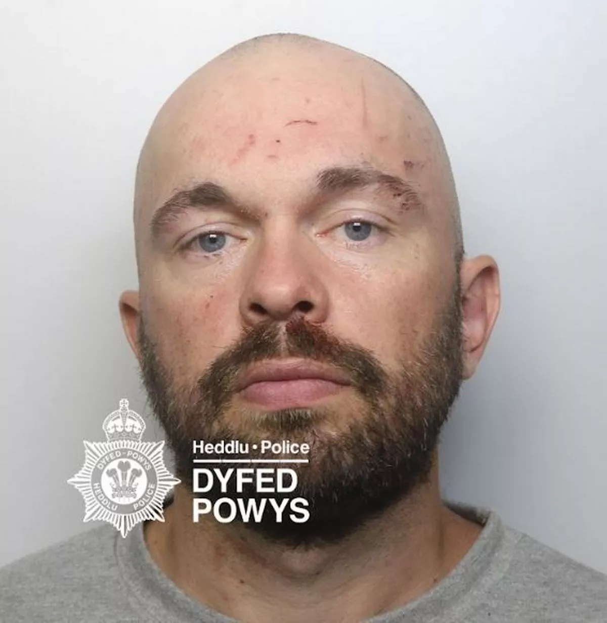 Featured image for “Llanelli Man Jailed for Sadistic Attack on Partner”