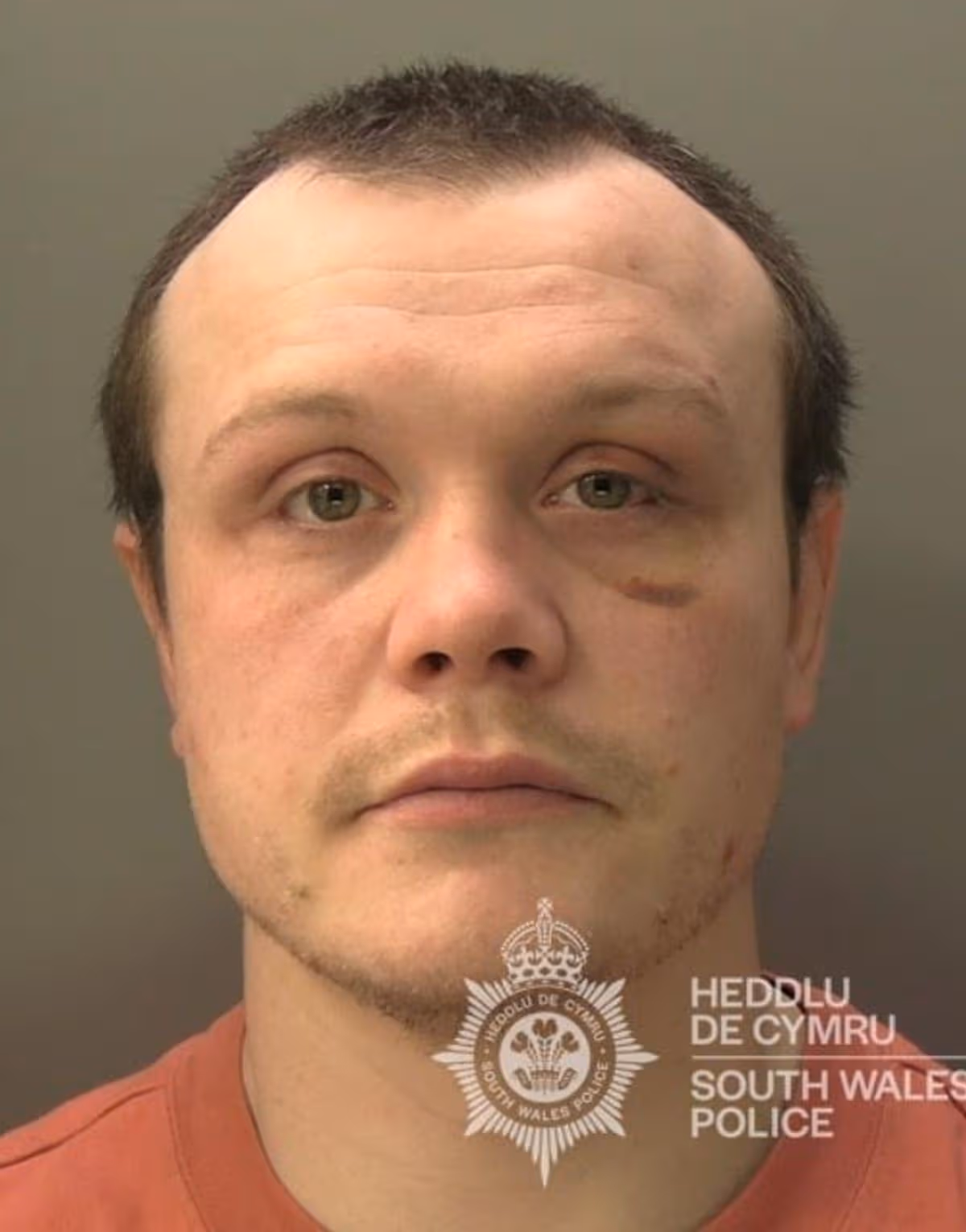 Featured image for “Drug dealer answered phone to police thinking they were a customer”